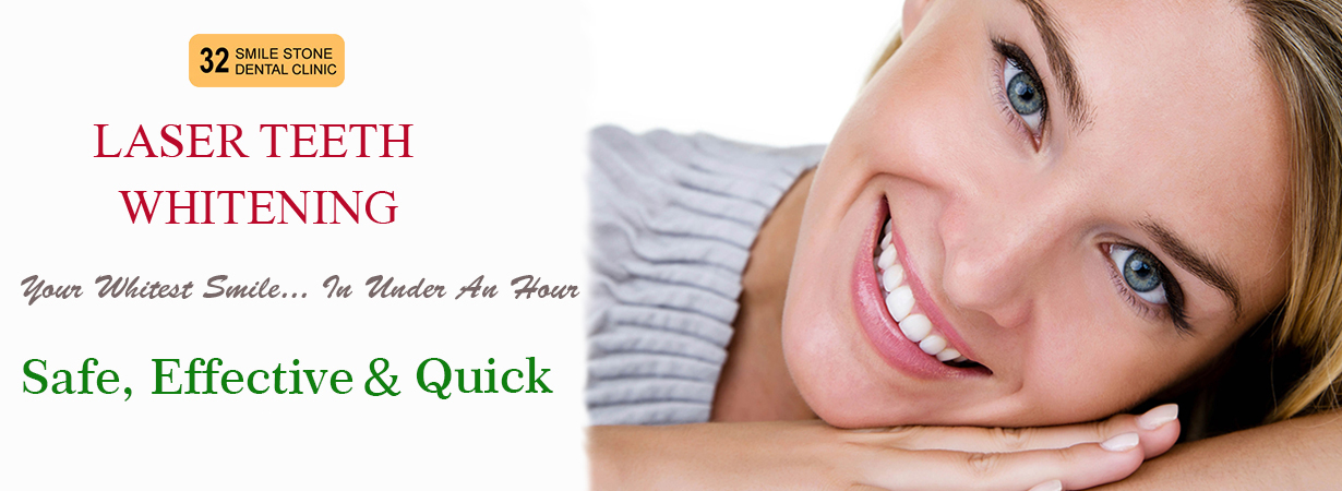 Top Dentist in Delhi- 32 Smile Stone Dental Clinic